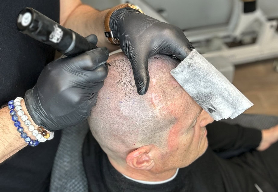 Resurgens-Studio, travail de micropigmentation sur un modèle