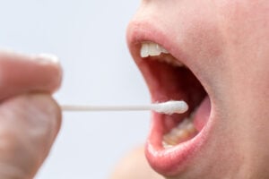 dépistage cancer buccal Medistetix