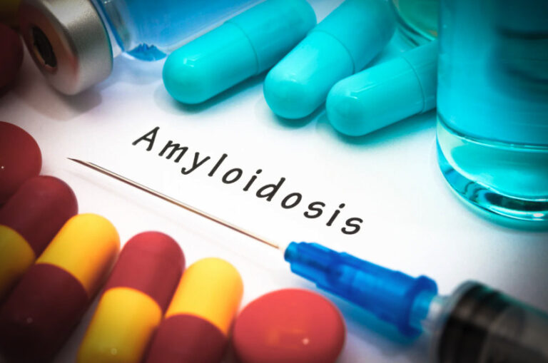 amylose-transthyretine-héréditaire